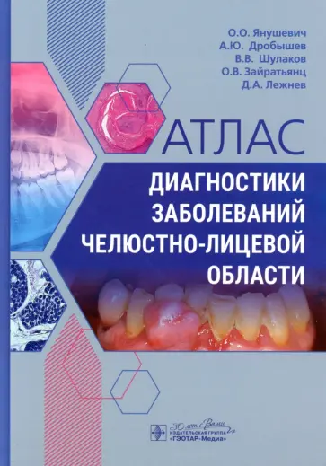 Янушевич, Дробышев - Атлас диагностики заболеваний челюстно-лицевой области обложка книги