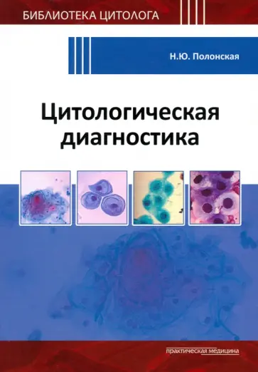 Наталья Полонская - Цитологическая диагностика Наталья Полонская - Цитологическая диагностика обложка книги