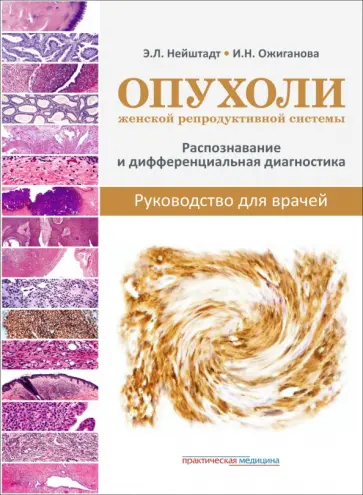 Нейштадт, Ожиганова - Опухоли женской репродуктивной системы. Распознавание и дифференциальная диагностика. Руководство обложка книги