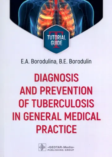 Бородулина, Бородулин - Diagnosis and prevention of tuberculosis in general medical practice. Tutorial guide Бородулина, Бородулин - Diagnosis and prevention of tuberculosis in general medical practice. Tutorial guide обложка книги