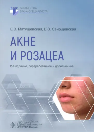 Матушевская, Свирщевская - Акне и розацеа Матушевская, Свирщевская - Акне и розацеа обложка книги