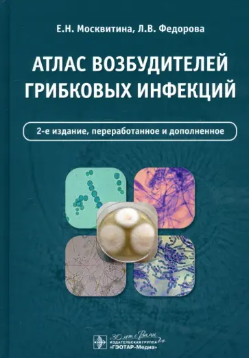 Москвитина, Федорова - Атлас возбудителей грибковых инфекций Москвитина, Федорова - Атлас возбудителей грибковых инфекций обложка книги