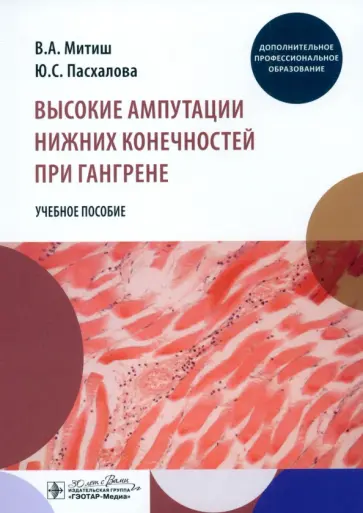 Митиш, Пасхалова - Высокие ампутации нижних конечностей при гангрене. Учебное пособие Митиш, Пасхалова - Высокие ампутации нижних конечностей при гангрене. Учебное пособие обложка книги
