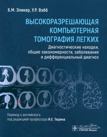 Эликер, Вэбб - Высокоразрешающая компьютерная томография легких. Диагностические находки, общие закономерности обложка книги