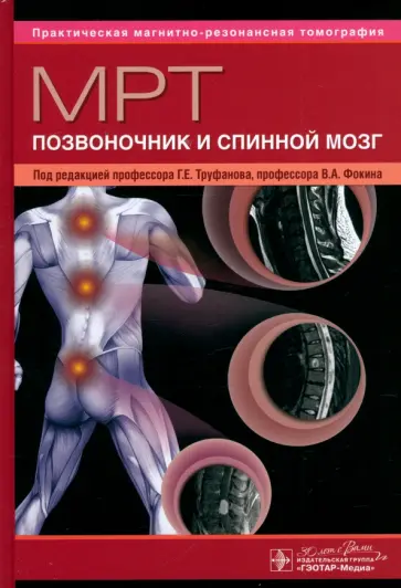 МРТ. Позвоночник и спинной мозг. Руководство для врачей МРТ. Позвоночник и спинной мозг. Руководство для врачей обложка книги