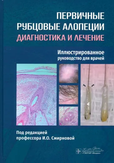 Смирнова, Бессалова - Первичные рубцовые алопеции. Диагностика и лечение. Иллюстрированное руководство для врачей Смирнова, Бессалова - Первичные рубцовые алопеции. Диагностика и лечение. Иллюстрированное руководство для врачей обложка книги