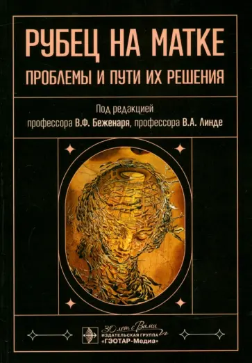 Беженарь, Линде - Рубец на матке. Проблемы и пути их решения Беженарь, Линде - Рубец на матке. Проблемы и пути их решения обложка книги