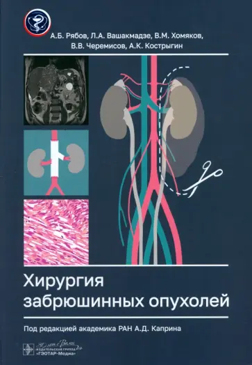 Рябов, Хомяков - Хирургия забрюшинных опухолей Рябов, Хомяков - Хирургия забрюшинных опухолей обложка книги