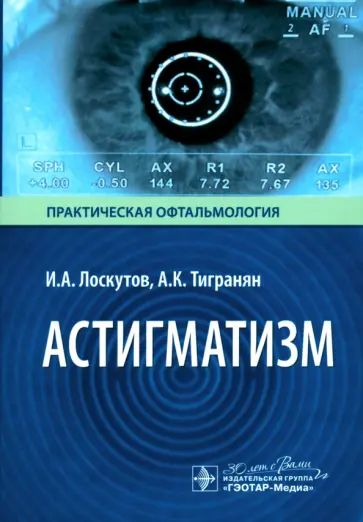 Лоскутов, Тигранян - Астигматизм обложка книги