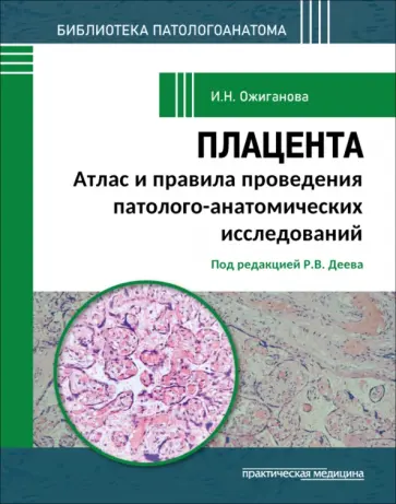 Ирина Ожиганова - Плацента. Атлас и правила проведения патолого-анатомических исследований обложка книги