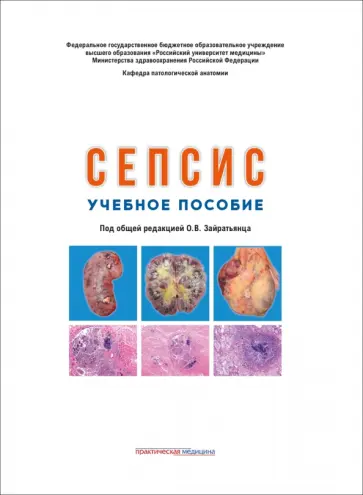 Сепсис. Учебное пособие обложка книги
