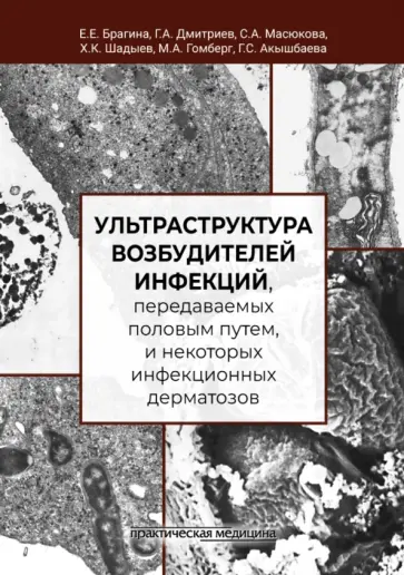 Брагина, Дмитриев - Ультраструктура возбудителей инфекций, передаваемых половым путем обложка книги