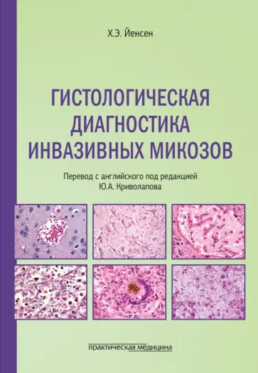 Хенрик Йенсен - Гистологическая диагностика инвазивных микозов обложка книги