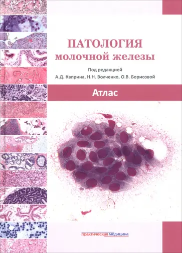 Борисова, Волченко - Патология молочной железы. Атлас обложка книги