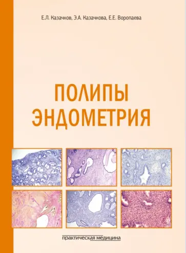 Казачков, Казачкова - Полипы эндометрия. Учебное пособие обложка книги