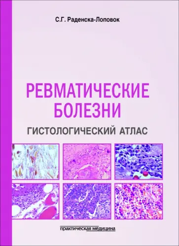 Стефка Раденска-Лоповок - Ревматические болезни. Гистологический атлас обложка книги