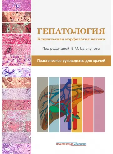 Цыркунова, Прокопчик - Гепатология. Клиническая морфология печени. Практическое руководство для врачей обложка книги