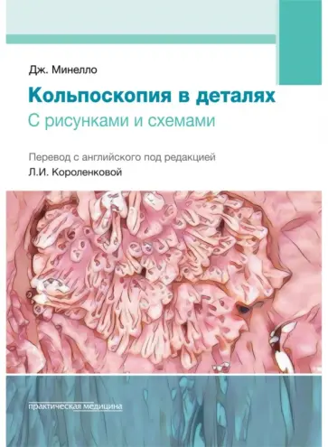 Джованни Минелло - Кольпоскопия в деталях. С рисунками и схемами обложка книги