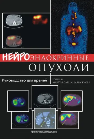 Кэплин, Кволс - Нейроэндокринные опухоли. Руководство для врачей обложка книги