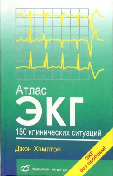 Джон Хэмптон - Атлас ЭКГ. 150 клинических ситуаций Джон Хэмптон - Атлас ЭКГ. 150 клинических ситуаций обложка книги