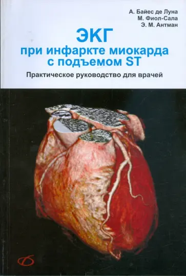 Байдес, Фиол-Сала - ЭКГ при инфаркте миокарда с подъемом ST Байдес, Фиол-Сала - ЭКГ при инфаркте миокарда с подъемом ST обложка книги