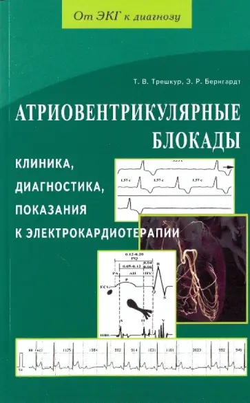 Трешкур, Бернгардт - Атриовентрикулярные блокады. Клиника, диагностика, показания к электрокардиотерапии Трешкур, Бернгардт - Атриовентрикулярные блокады. Клиника, диагностика, показания к электрокардиотерапии обложка книги