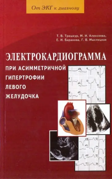 Трешкур, Баранова - Электрокардиограмма при асимметричной гипертрофии левого желудочка Трешкур, Баранова - Электрокардиограмма при асимметричной гипертрофии левого желудочка обложка книги