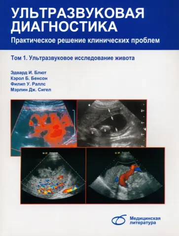 Блют, Бенсон - Ультразвуковая диагностика. Практическое решение клинических проблем. Том 1. УЗИ живота Блют, Бенсон - Ультразвуковая диагностика. Практическое решение клинических проблем. Том 1. УЗИ живота обложка книги