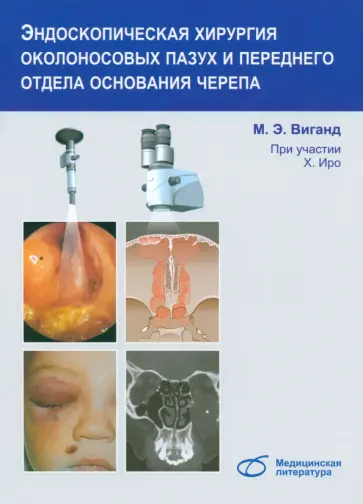 Виганд, Иро - Эндоскопическая хирургия околоносовых пазух и переднего отдела основания черепа Виганд, Иро - Эндоскопическая хирургия околоносовых пазух и переднего отдела основания черепа обложка книги