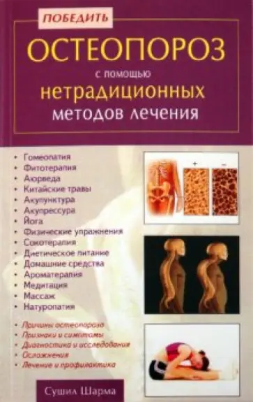 Сушил Шарма - Победить остеопороз с помощью нетрадиционных методов лечения Сушил Шарма - Победить остеопороз с помощью нетрадиционных методов лечения обложка книги