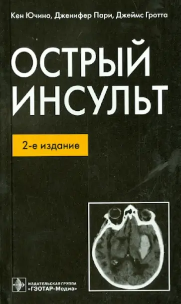 Ючино, Пари - Острый инсульт обложка книги