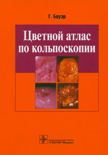 Ганскурт Бауэр - Цветной атлас по кольпоскопии Ганскурт Бауэр - Цветной атлас по кольпоскопии обложка книги