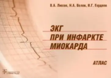 Люсов, Волов - ЭКГ при инфаркте миокарда: атлас обложка книги