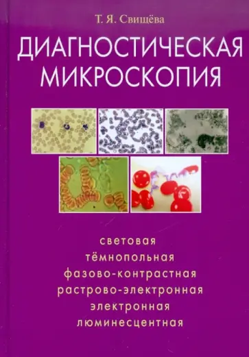 Тамара Свищева - Диагностическая микроскопия Тамара Свищева - Диагностическая микроскопия обложка книги