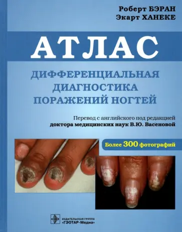 Бэран, Ханеке - Дифференциальная диагностика поражений ногтей. Атлас обложка книги