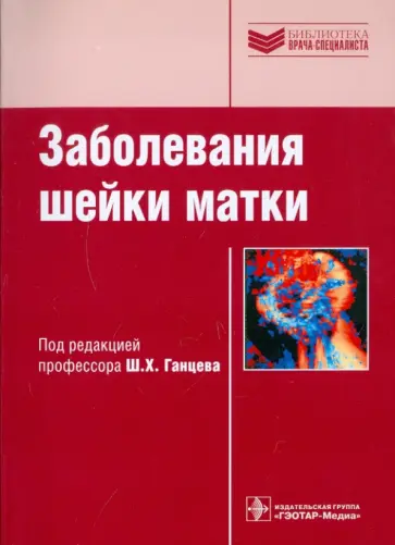 Ганцев, Рахматуллина - Заболевания шейки матки. Руководство Ганцев, Рахматуллина - Заболевания шейки матки. Руководство обложка книги