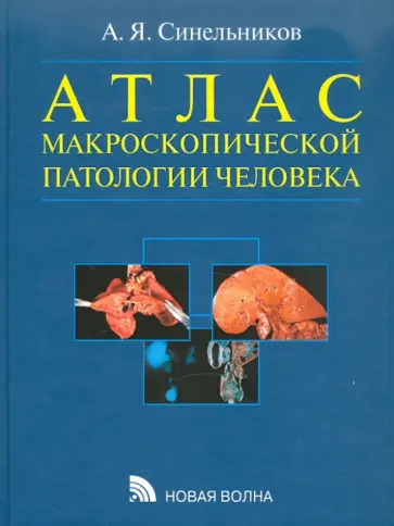 Александр Синельников - Атлас макроскопической патологии человека Александр Синельников - Атлас макроскопической патологии человека обложка книги