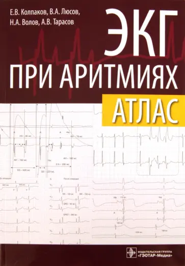 Колпаков, Люсов - ЭКГ при аритмиях. Атлас + линейка электрокардиографическая Колпаков, Люсов - ЭКГ при аритмиях. Атлас + линейка электрокардиографическая обложка книги