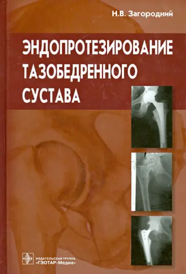 Николай Загородний - Эндопротезирование тазобедренного сустава. Основы и практика. Руководство обложка книги