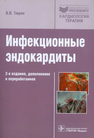 Владимир Тюрин - Инфекционные эндокардиты. Руководство обложка книги