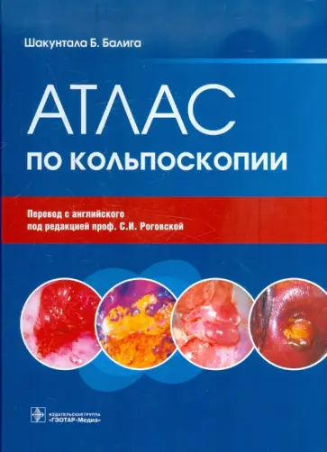 Шакунтала Балига - Атлас по кольпоскопии Шакунтала Балига - Атлас по кольпоскопии обложка книги