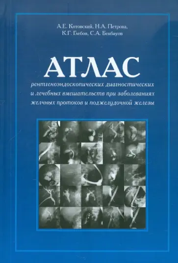 Котовский, Бекбауов - Атлас рентгеноэндоскоп. диагностич. и лечебных вмешательств при заб. желчных протоков и подж. железы обложка книги