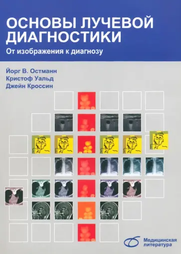 Остманн, Уальд - Основы лучевой диагностики. От изображения к диагнозу Остманн, Уальд - Основы лучевой диагностики. От изображения к диагнозу обложка книги