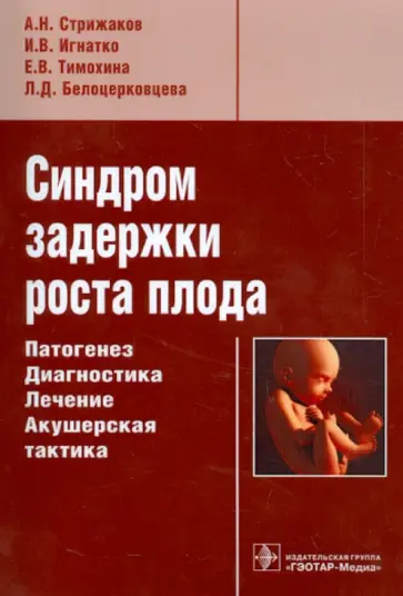 Стрижаков, Игнатко - Синдром задержки роста плода. Патогенез. Диагностика. Лечение. Акушерская тактика Стрижаков, Игнатко - Синдром задержки роста плода. Патогенез. Диагностика. Лечение. Акушерская тактика обложка книги