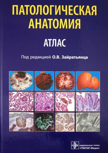 Зайратьянц, Бойкова - Патологическая анатомия. Атлас. Учебное пособие Зайратьянц, Бойкова - Патологическая анатомия. Атлас. Учебное пособие обложка книги