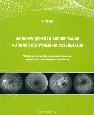 Эдвард Черни - Флюоресцентная ангиография и анализ получаемых результатов. Методическое пособие для врачей-интернов обложка книги