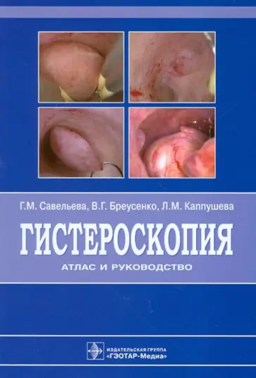 Савельева, Бреусенко - Гистероскопия. Атлас и руководство обложка книги