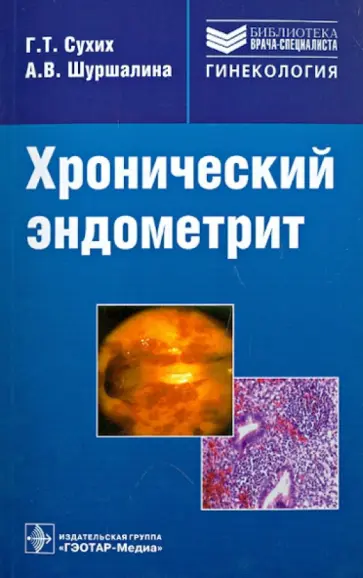 Сухих, Шуршалина - Хронический эндометрит: руководство обложка книги