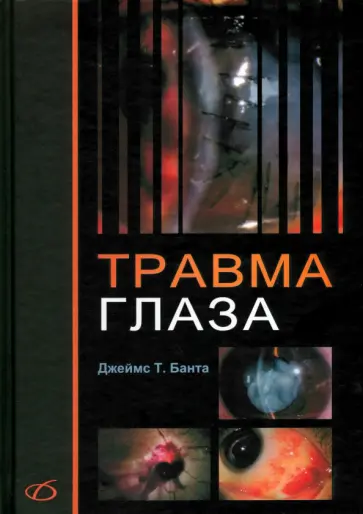 Джеймс Банта - Травма глаза обложка книги
