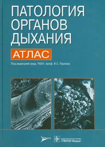 Коган, Пауков - Патология органов дыхания. Атлас Коган, Пауков - Патология органов дыхания. Атлас обложка книги